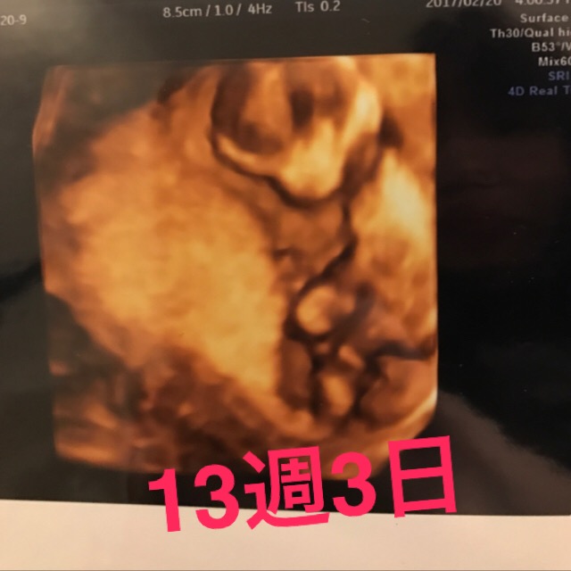 【画像あり】妊娠4ヶ月(妊娠12週13週14週15週)の胎児の大きさやお腹の出方の記録【エコー写真】 — キラキラままライフ 【画像あり】妊娠4ヶ月(妊娠12週13週14週15週)の胎児の大きさやお腹の出方の記録【エコー写真】 — キラキラままライフ
